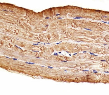 IHC testing of FFPE human skeletal muscle tissue with MAP4K3 antibody. HIER: steam section in pH6 ci