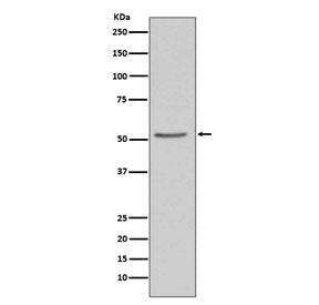 Western blot testing of human 293T cell lysate with Angiotensinogen antibody. Predicted molecular we