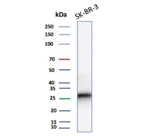 Western blot testing of human SK-BR-3 cell lysate with recombinant CDKN1B antibody (clone rCDKN1B/13