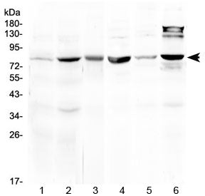 Western blot testing of 1) rat liver, 2) mouse liver, 3) mouse heart, 4) mouse testis, 5) human MCF7