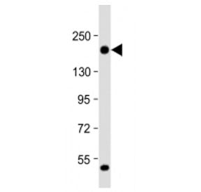 THBS1 Antibody
