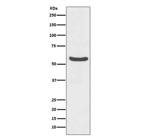 GLUT2 Antibody / SLC2A2
