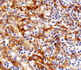 FYN Antibody