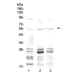 Western blot testing of 1) rat brain, 2) mouse liver and 3) human A549 lysate with PTEN antibody at
