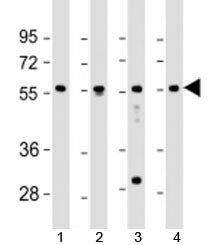 Western blot testing of human 1) fetal liver, 2) lung, 3) Jurkat and 4) K562 cell lysate with EFS an