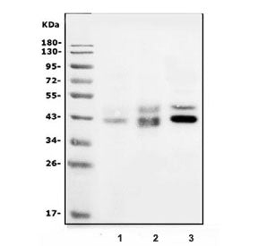 TRAIL R2 Antibody / DR5