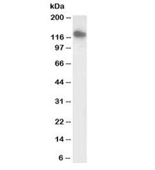 Western blot testing of human heart lysate with biotinylated SLC12A6 antibody at 0.1ug/ml. Predicted