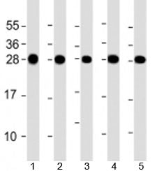 Western blot testing of human 1) HeLa, 2) Jurkat, 3) MCF-7, 4) U-2OS and 5) A431 cell lysate with RP