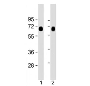Western blot testing of LAT1 antibody at 1:2000: Lane 1) human lung and 2) placenta lysate. Predicte