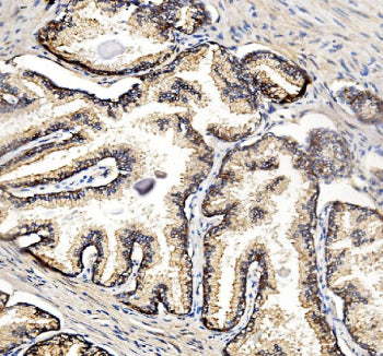Flow cytometry testing of human PC-3 cells with NDRG1 antibody at 1ug/million cells (blocked with go
