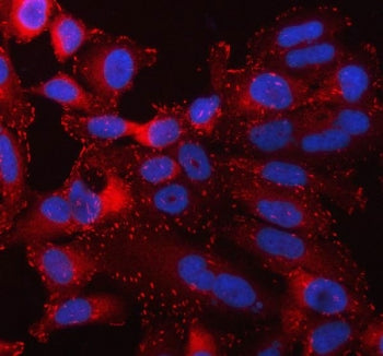 Immunofluorescent staining of FFPE human HeLa cells with TLN1 antibody (red) and DAPI nuclear stain