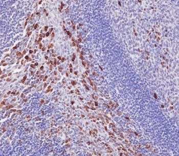 IRAK3 Antibody
