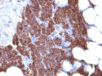 Parathyroid Hormone Antibody Cocktail / N + C Terminal