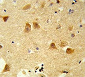 DERL1 Antibody / Derlin 1