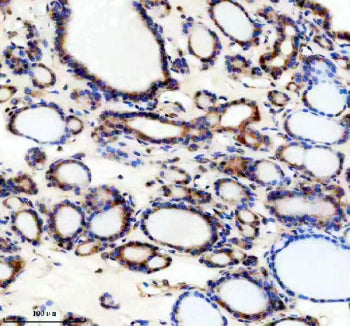 Immunohistochemical staining of TRIM32 using anti-TRIM32 antibody. TRIM32 was detected in a paraffin