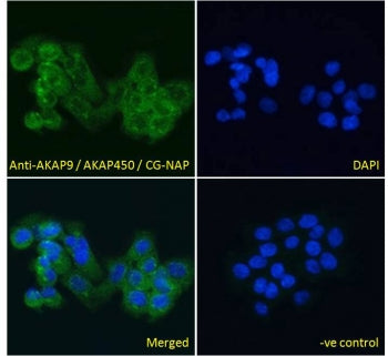 IF/ICC testing of fixed and permeabilized human A431 cells with AKAP9 antibody (green) at 10ug/ml an