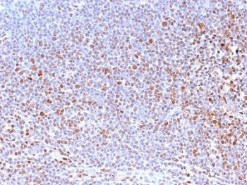 Nuclear Antigen Antibody