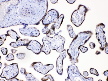 Angiopoietin 2 Antibody (ANG2)