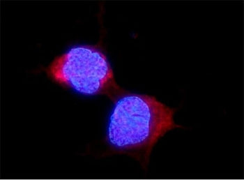 ALDH2 Antibody