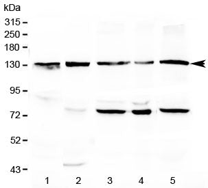 Western blot testing of 1) rat liver, 2) mouse liver, 3) human MCF7, 4) human COLO320 and 5) human H