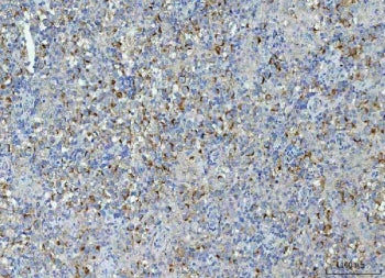 TMEM87A Antibody / Elkin1