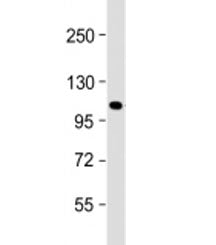Western blot testing of mouse NIH3T3 cell lysate with GLI1 antibody at 1:2000. Expected molecular we