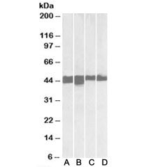 Western blot testing of A) human skeletal muslce, B) mouse skeletal muscle, C) human heart and D) mo