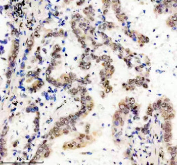 FTO Antibody / Fat mass and obesity associated protein, 100ul