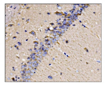 Dynamin 3 Antibody / DNM3