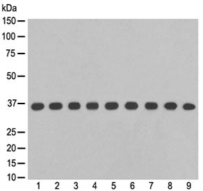 Western blot testing of 1) human Jurkat, 2) human A375, 3) human hippocampus, 4) human fetal liver,