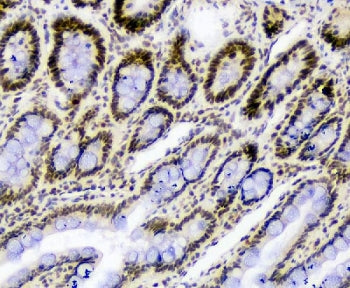 IHC staining of FFPE rat small intestine tissue with Splicing factor 1 antibody. HIER: boil tissue s