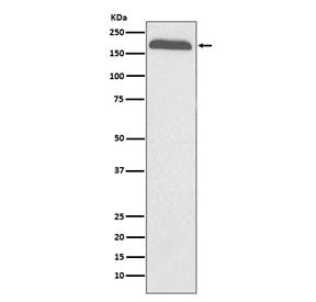 Alpha-2-macroglobulin Antibody / A2M