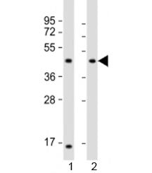 LIAS Antibody / Lipoic acid synthetase