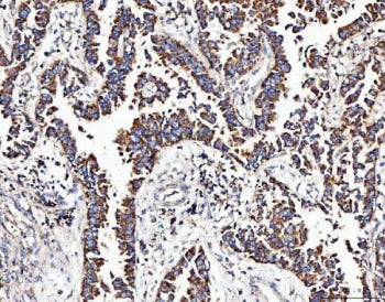MOCS1 Antibody / Molybdenum cofactor biosynthesis protein 1