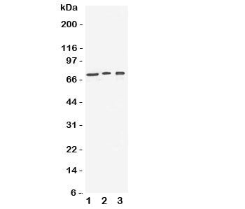 Western blot testing of VGF antibody and Lane 1: human U87; 2: (h) SHG-44; 3: mouse Neuro-2a cell ly