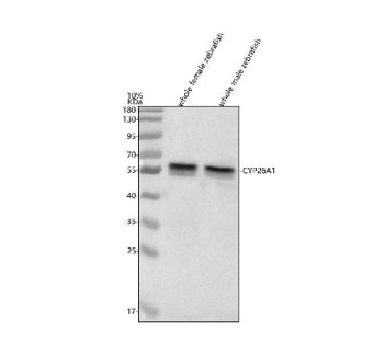Western blot analysis of Cyp26a1 protein using Zebrafish Cyp26a1 antibody and 1) whole female zebraf