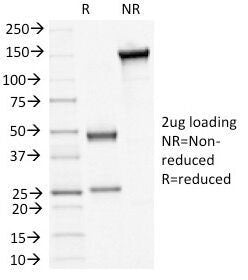 SDS-PAGE Analysis of Purified, BSA-Free Desmoglein 3 Antibody (clone 5H10). Confirmation of Integrit