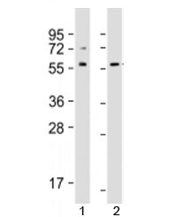 Western blot testing of human 1) Jurkat and 2) A431 cell lysate with SRC antibody at 1:1000. Predict