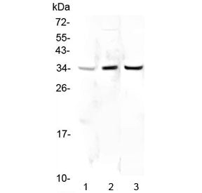 Western blot testing of human 1) HeLa, 2) placenta and 3) PC-3 lysate with PPCS antibody at 0.5ug/ml