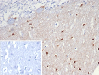 SCGN Antibody / Secretagogin