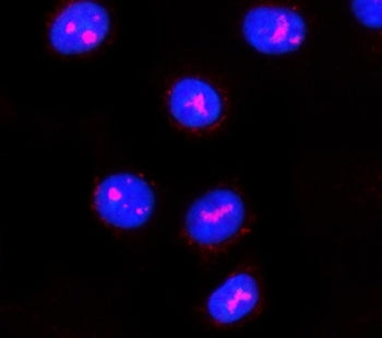 Immunofluorescent staining of FFPE human A549 cells with PPAN antibody (red) and DAPI nuclear stain