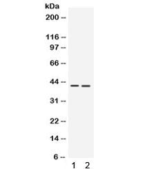 NDRG2 Antibody
