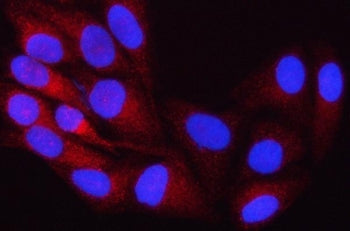 Immunofluorescent staining of FFPE human HeLa cells with ORP8 antibody (red) and DAPI nuclear stain
