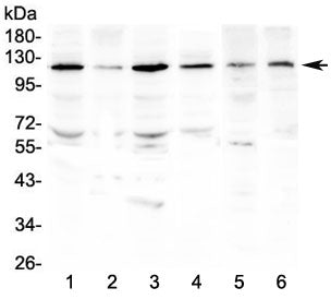 Platelet Derived Growth Factor Receptor beta Antibody / PDGFRB