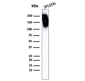 Western blot testing of human spleen lysate with CD45RB antibody. Expected molecular weight: 147-220