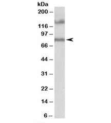 Western blot testing of human hippocampus lysate with EPB41L5 antibody at 1ug/ml. The expected ~80 k
