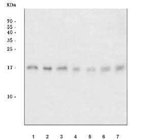 Adipocyte acid phosphatase Antibody / ACP1