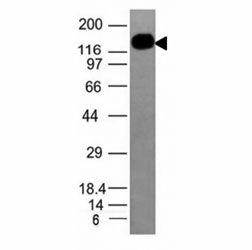 Western blot analysis of HL-60 cell lysate using ICAM3 antibody (ICAM3/1019). Observed molecular wei
