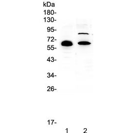 Western blot testing of human 1) placenta and 2) HL-60 lysate with CCDC36 antibody at 0.5ug/ml. Pred