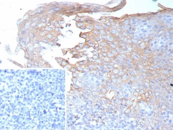 IHC staining of FFPE human tonsil tissue with Interferon gamma antibody (clone IFNG/9012). Inset: PB